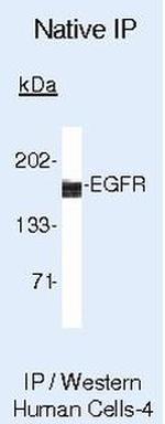 EGFR Antibody in Immunoprecipitation (IP)