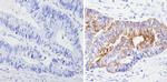 Cytokeratin Pan Antibody in Immunohistochemistry (Paraffin) (IHC (P))