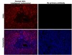 PMEL Antibody in Immunohistochemistry (Paraffin) (IHC (P))