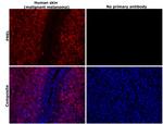 PMEL Antibody in Immunohistochemistry (Paraffin) (IHC (P))