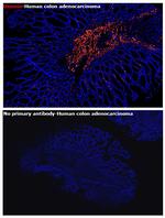 Desmin Antibody in Immunohistochemistry (Paraffin) (IHC (P))