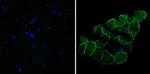 Desmin Antibody in Immunocytochemistry (ICC/IF)