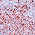 Desmin Antibody in Immunohistochemistry (Paraffin) (IHC (P))