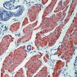 Desmin Antibody in Immunohistochemistry (Paraffin) (IHC (P))