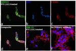 Chromogranin A Antibody in Immunocytochemistry (ICC/IF)