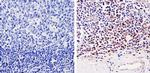 Cdk6 Antibody in Immunohistochemistry (Paraffin) (IHC (P))