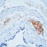 Thrombospondin 1 Antibody in Immunohistochemistry (Paraffin) (IHC (P))