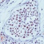 XRCC1 Antibody in Immunohistochemistry (Paraffin) (IHC (P))