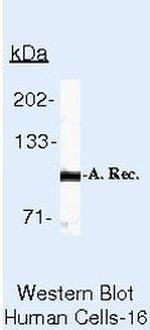 Androgen Receptor Antibody in Western Blot (WB)