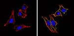 CD155 Antibody in Immunocytochemistry (ICC/IF)