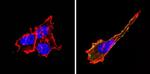 CD155 Antibody in Immunocytochemistry (ICC/IF)