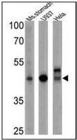 CD155 Antibody in Western Blot (WB)