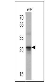 CD81 Antibody in Western Blot (WB)