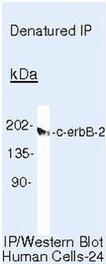 ErbB2 (HER-2) Antibody in Immunoprecipitation (IP)