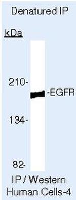 EGFR Antibody in Immunoprecipitation (IP)