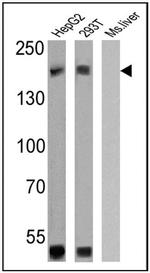 P-Glycoprotein Antibody in Western Blot (WB)