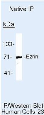 Ezrin Antibody in Immunoprecipitation (IP)