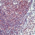 Mcl-1 Antibody in Immunohistochemistry (Paraffin) (IHC (P))