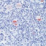 Bcl-X Antibody in Immunohistochemistry (Paraffin) (IHC (P))