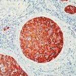 MUC1 Antibody in Immunohistochemistry (Paraffin) (IHC (P))