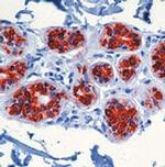 Cytokeratin 8/18 Antibody in Immunohistochemistry (Paraffin) (IHC (P))