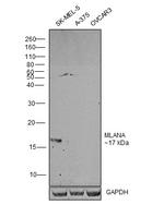 Melan-A Antibody in Western Blot (WB)