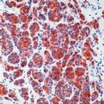 Melan-A Antibody in Immunohistochemistry (Paraffin) (IHC (P))