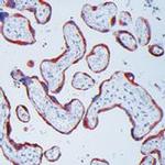 MMP13 Antibody in Immunohistochemistry (Paraffin) (IHC (P))