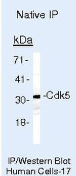 Cdk5 Antibody in Immunoprecipitation (IP)