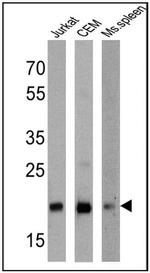 CD3e Antibody in Western Blot (WB)