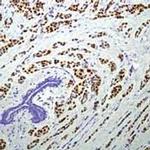 Progesterone Receptor Antibody in Immunohistochemistry (Paraffin) (IHC (P))