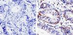 Cyclin D1 Antibody in Immunohistochemistry (Paraffin) (IHC (P))