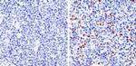 Cyclin D1 Antibody in Immunohistochemistry (Paraffin) (IHC (P))