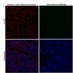 Ki-67 Antibody in Immunohistochemistry (Paraffin) (IHC (P))