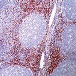 CD8 Antibody in Immunohistochemistry (Paraffin) (IHC (P))