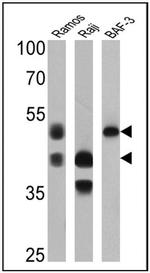 CD79a Antibody in Western Blot (WB)