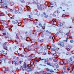 COX2 Antibody in Immunohistochemistry (Paraffin) (IHC (P))