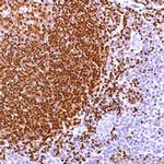 PAX5 Antibody in Immunohistochemistry (Paraffin) (IHC (P))