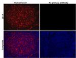 CD14 Antibody in Immunohistochemistry (Paraffin) (IHC (P))