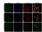 JMJD1B Antibody