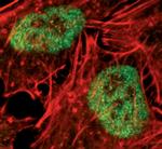 JMJD1B Antibody in Immunocytochemistry (ICC/IF)