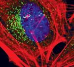 EEA1 Antibody in Immunocytochemistry (ICC/IF)