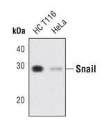 SNAIL Antibody in Western Blot (WB)