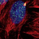 SETD8 Antibody in Immunocytochemistry (ICC/IF)