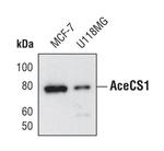 ACSS2 Antibody in Western Blot (WB)