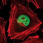 AP2 alpha Antibody in Immunocytochemistry (ICC/IF)