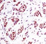 H3K36me2 Antibody in Immunohistochemistry (Paraffin) (IHC (P))