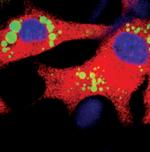 SCD Antibody in Immunocytochemistry (ICC/IF)