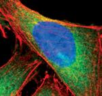 FASN Antibody in Immunocytochemistry (ICC/IF)