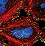 NUMB Antibody in Immunocytochemistry (ICC/IF)